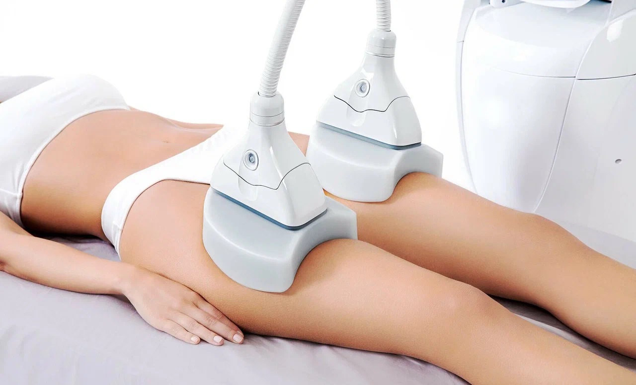 criolipoliza cu aparatul Cryo